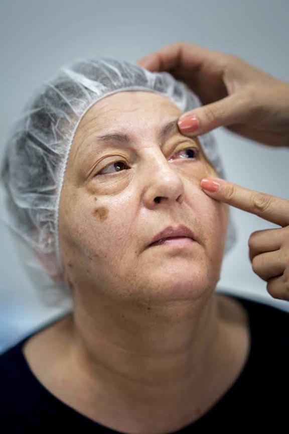 Patients of the Armenia Eyecare Project are given eye examines, as well as their results, in just one visit