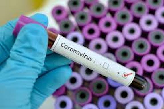 Number of Coronavirus cases in Armenia is rapidly growing